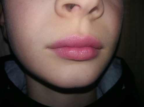 MOISTURIZING LIP BALM WITH ALOE VERA JELLY (99%)