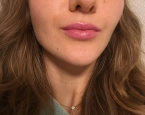 MOISTURIZING LIP BALM WITH ALOE VERA JELLY (99%)