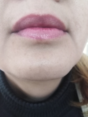 MOISTURIZING LIP BALM WITH ALOE VERA JELLY (99%)