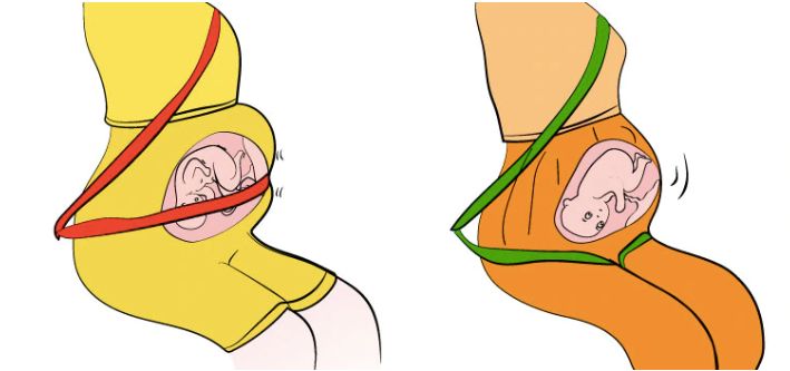 SEAT BELT ADJUSTER FOR PREGNANT WOMEN